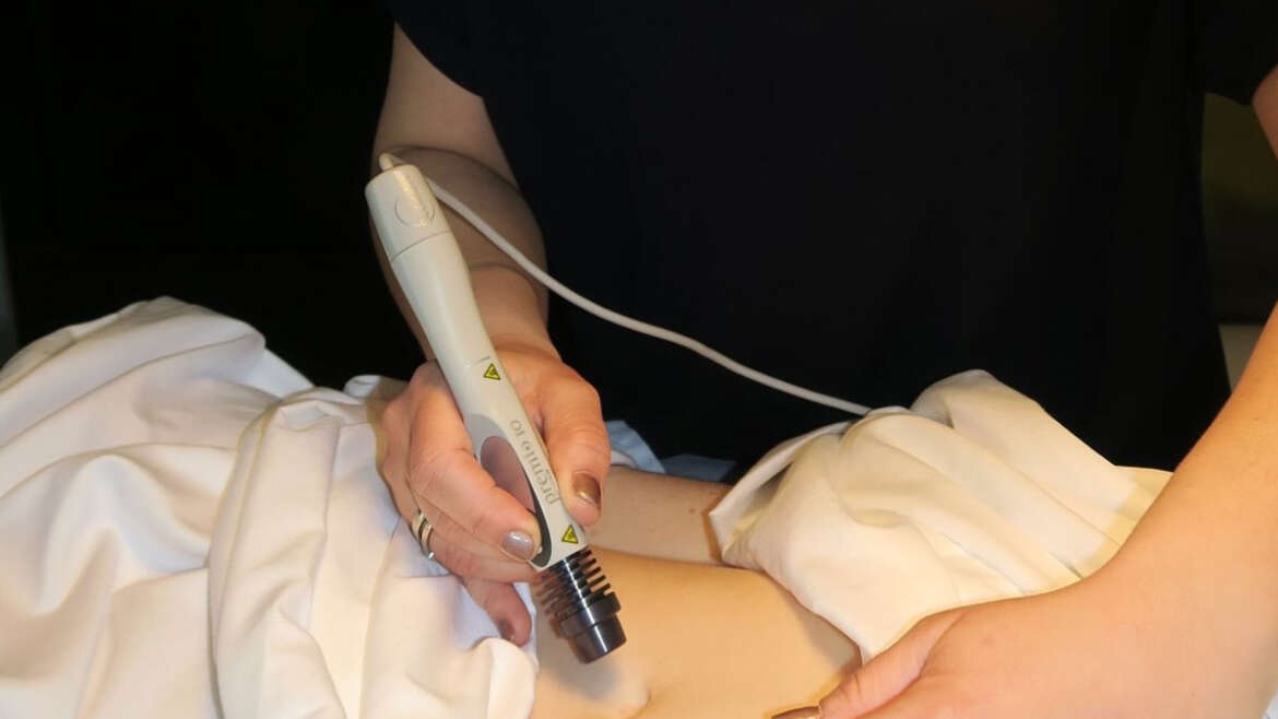 Moxibustion